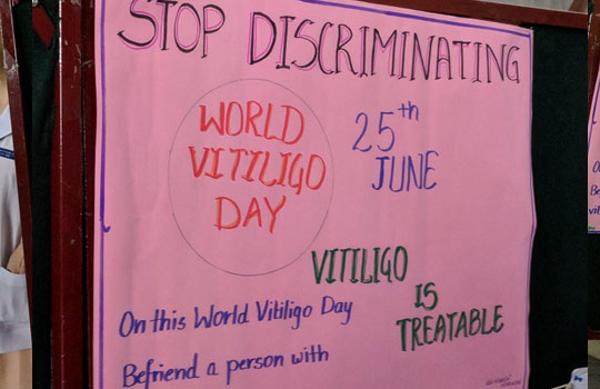World Vitiligo Day